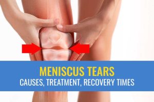 Meniscus Injury Treatment: Comprehensive Guide