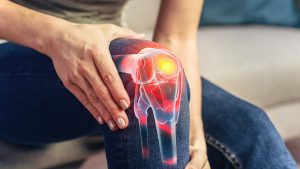 Anterior Cruciate Ligament Repair: Treatment Options and Recovery