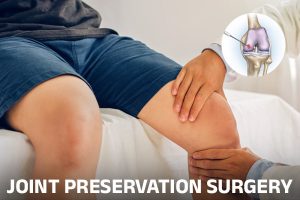 Joint Preservation Surgery: Techniques and Benefits