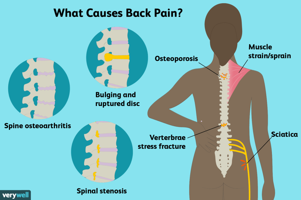 Lower Back Pain: Causes, Symptoms & Treatment