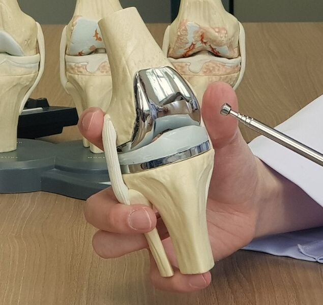 orthopaedic doctor in Gorakhpur