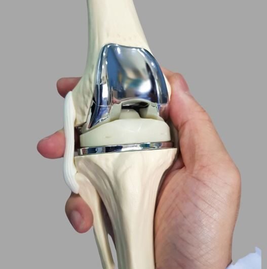 Knee replacement doctor in Gorakhpur