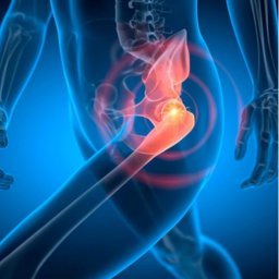 Hip Replacement surgery in Deoria