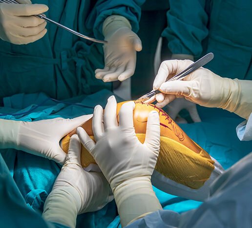 Total Knee Replacement Surgery in Deoria by Dr. Vatsal Khetan