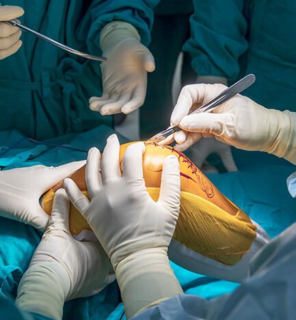 Total Knee Replacement Surgery in Deoria by Dr. Vatsal Khetan